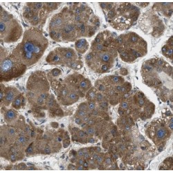 Carnitine O-Octanoyltransferase (CROT) Antibody