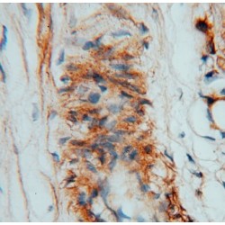Chorionic Somatomammotropin Hormone-Like 1 (CSHL1) Antibody