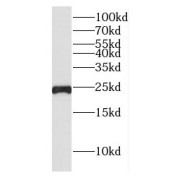 WB analysis of human placenta tissue, using CSHL1 antibody (1/1000 dilution).