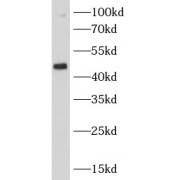 WB analysis of Jurkat cells, using CSK antibody (1/1000 dilution).