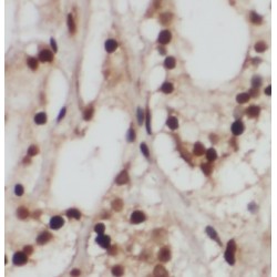 COP9 Signalosome Complex Subunit 1 (GPS1) Antibody
