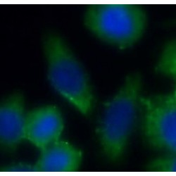 Casein Kinase II Subunit Alpha (CSNK2A1) Antibody