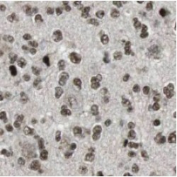 Casein Kinase II Subunit Alpha (CSNK2A1) Antibody