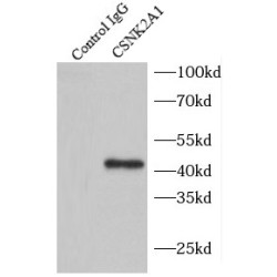Casein Kinase II Subunit Alpha (CSNK2A1) Antibody