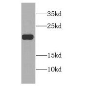 WB analysis of mouse liver tissue, using CSRP2 antibody (1/1000 dilution).
