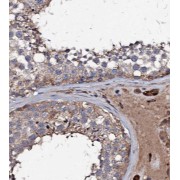 IHC-P analysis of human testis tissue, using CSTL1-Specific antibody (1/50 dilution).