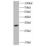 WB analysis of human kidney tissue, using CTDSP2 antibody (1/400 dilution).