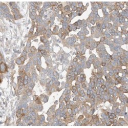 CTD Small Phosphatase-Like Protein 2 (CTDSPL2) Antibody
