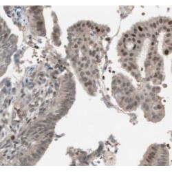 RNA Polymerase-Associated Protein CTR9 Homolog (CTR9) Antibody