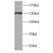 WB analysis of HeLa cells, using CTR9 antibody (1/500 dilution).