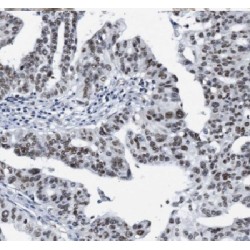 RNA Polymerase-Associated Protein CTR9 Homolog (CTR9) Antibody
