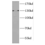 WB analysis of HeLa cells, using CTR9 antibody (1/500 dilution).