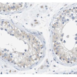 Cortactin-Binding Protein 2 (CTTNBP2) Antibody