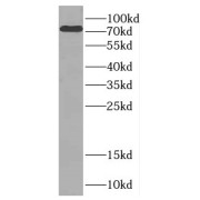 WB analysis of MCF-7 cells, using CTTNBP2NL antibody (1/1000 dilution).