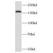 WB analysis of mouse brain tissue, using CUX2 antibody (1/300 dilution).