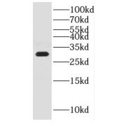 WB analysis of mouse liver tissue, using CWC15 antibody (1/600 dilution).