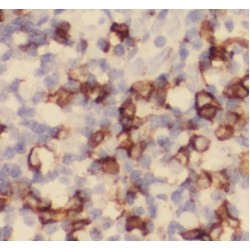 Chemokine C-X3-C-Motif Motif Receptor 1 (CX3CR1) Antibody