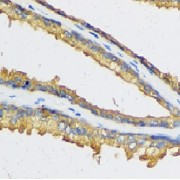 IHC-P analysis of human prostate tissue, using CXCL11 antibody (1/50 dilution).
