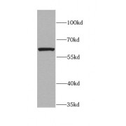 WB analysis of rat spleen tissue, using CXCR4 antibody (1/1000 dilution).