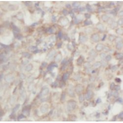 Chemokine C-X-C-Motif Receptor 7 (CXCR7) Antibody