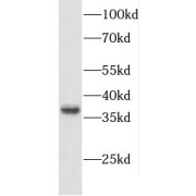 WB analysis of mouse brain tissue, using CXXC5 antibody (1/600 dilution).