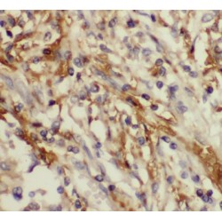 NADH-Cytochrome B5 Reductase 3 (CYB5R3) Antibody