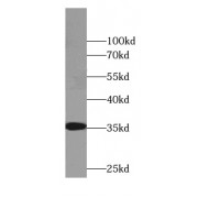 WB analysis of HepG2 cells, using CYB5R3 antibody (1/1000 dilution).