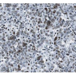 Cyclin H (CCNH) Antibody