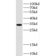 WB analysis of HEK-293 cells, using Cyclophilin E antibody (1/1500 dilution).