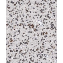 Cytoplasmic FMR1-Interacting Protein 2 (CYFIP2) Antibody
