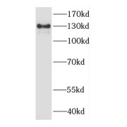 WB analysis of human brain tissue, using CYFIP2 antibody (1/1000 dilution).