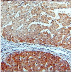 Cytochrome P450 26B1 (CYP26B1) Antibody