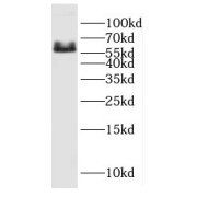 WB analysis of human brain tissue, using CYP26B1 antibody (1/500 dilution).