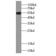 WB analysis of Jurkat cells, using CYP2E1 antibody (1/1000 dilution).