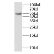 WB analysis of mouse lung tissue, using CYP2S1 antibody (1/300 dilution).