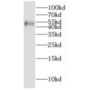 WB analysis of HepG2 cells, using CYP2W1 antibody (1/400 dilution).