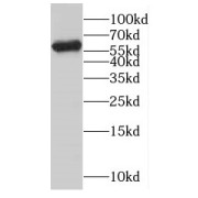 WB analysis of HL-60 cells, using CYP4F3 antibody (1/300 dilution).