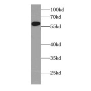 WB analysis of MDA-MB-453s cells, using CYP4Z1-Specific antibody (1/600 dilution).