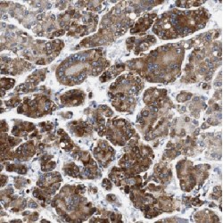 Cytochrome P450 7B1 (CYP7B1) Antibody