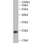 WB analysis of mouse heart tissue, using CYGB antibody (1/1500 dilution).