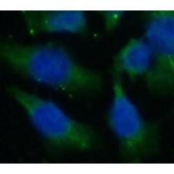 Cytoglobin (CYGB) Antibody