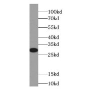 WB analysis of human heart tissue, using CYGB antibody (1/1000 dilution).