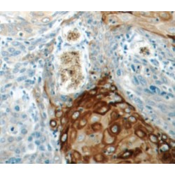 Keratin, Type I Cytoskeletal 15 (KRT15) Antibody