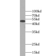 WB analysis of mouse thymus tissue, using KRT15 antibody (1/1000 dilution).
