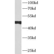 WB analysis of A431 cells, using Cytokeratin 15 antibody (1/1000 dilution).