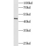 WB analysis of HeLa cells, using KRT16 antibody (1/1000 dilution).
