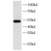 WB analysis of HeLa cells, using KRT17 antibody (1/600 dilution).