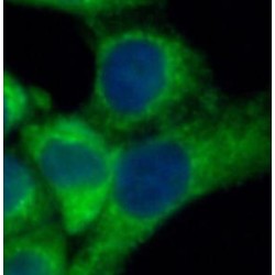 Cytokeratin 18 (CYK18) Antibody
