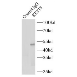 Cytokeratin 18 (CYK18) Antibody