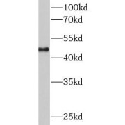 WB analysis of A431 cells, using KRT18 antibody (1/1000 dilution).